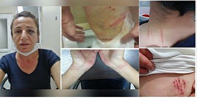 Köpekle işkence yapmaktan 3 ayrı dosyadan yargılan polis beraat etti 